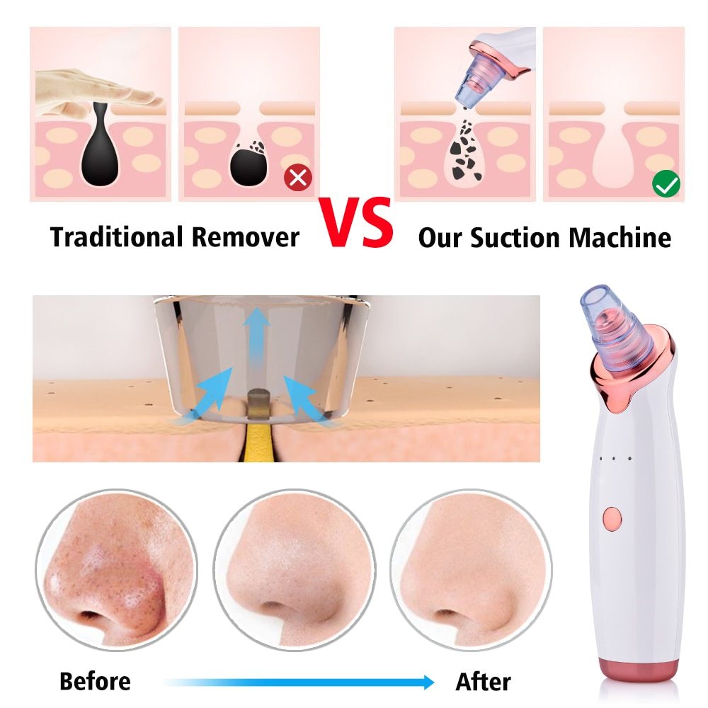 Blackhead Remover & Face Washing Instrument